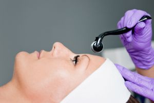 Le microneedling pour une peau éclatante et revivifiée