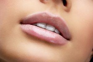 Acide hyaluronique lèvres : retrouver un sourire pulpeux
