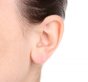 L’otoplastie pour corriger les oreilles décollées