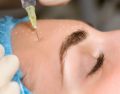 La toxine botulique (Botox®), une technique légère et sûre