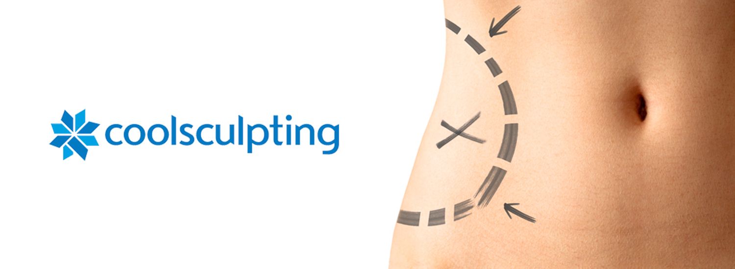 Coolsculpting Avignon