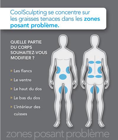 Coolsculpting