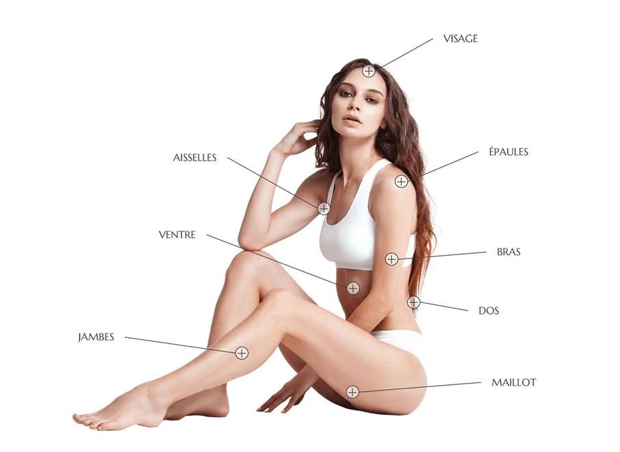 Zones pour l'&eacute;pilation laser